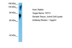 TFIP11 Antibody, Novus Biologicals 100 &mu;L | Buy Online | Novus Biologicals | Fisher Scientific